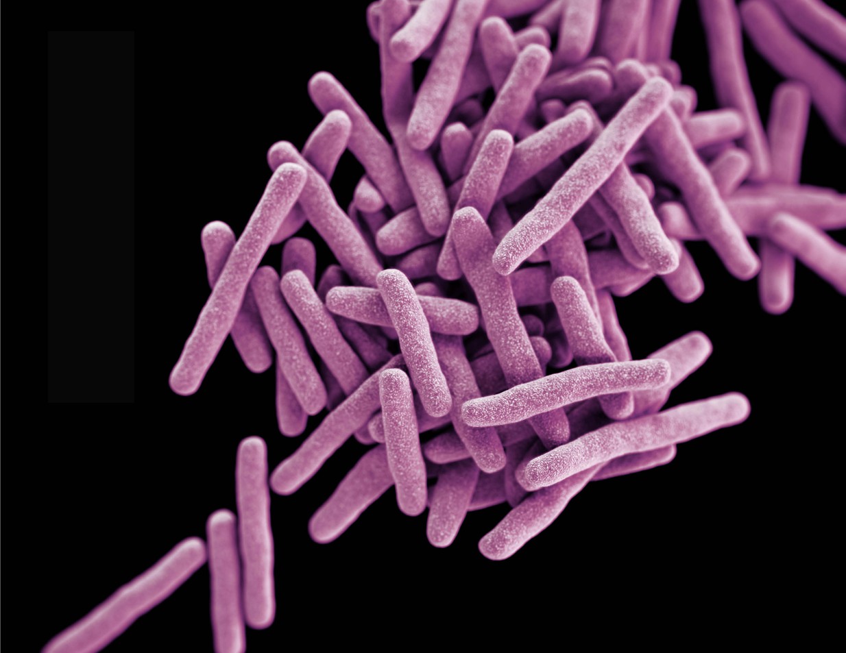 Tuberculosis (TB): What it is, and what to do about it.